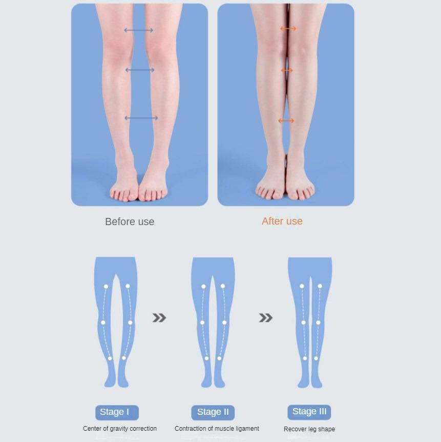 ПУ Ортопедическая стелька Поддержка свода стопы Плоскостопие Ортопедические стельки для обуви Женские Мужские Ноги X/O типа Вальгусные стопы Коррекция Подушечки для обуви