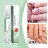 3ml Nail Growth Care Solution Nail And Cuticle Care, Cuticle Oil Pen, Keratin Pen, Travel-Sized Beauty, A New That Repairs Damaged Nails