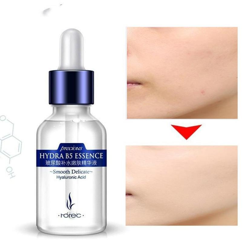 Rorec Антивозрастная лифтинг-сыворотка для лица с гиалуроновой кислотой 15мл