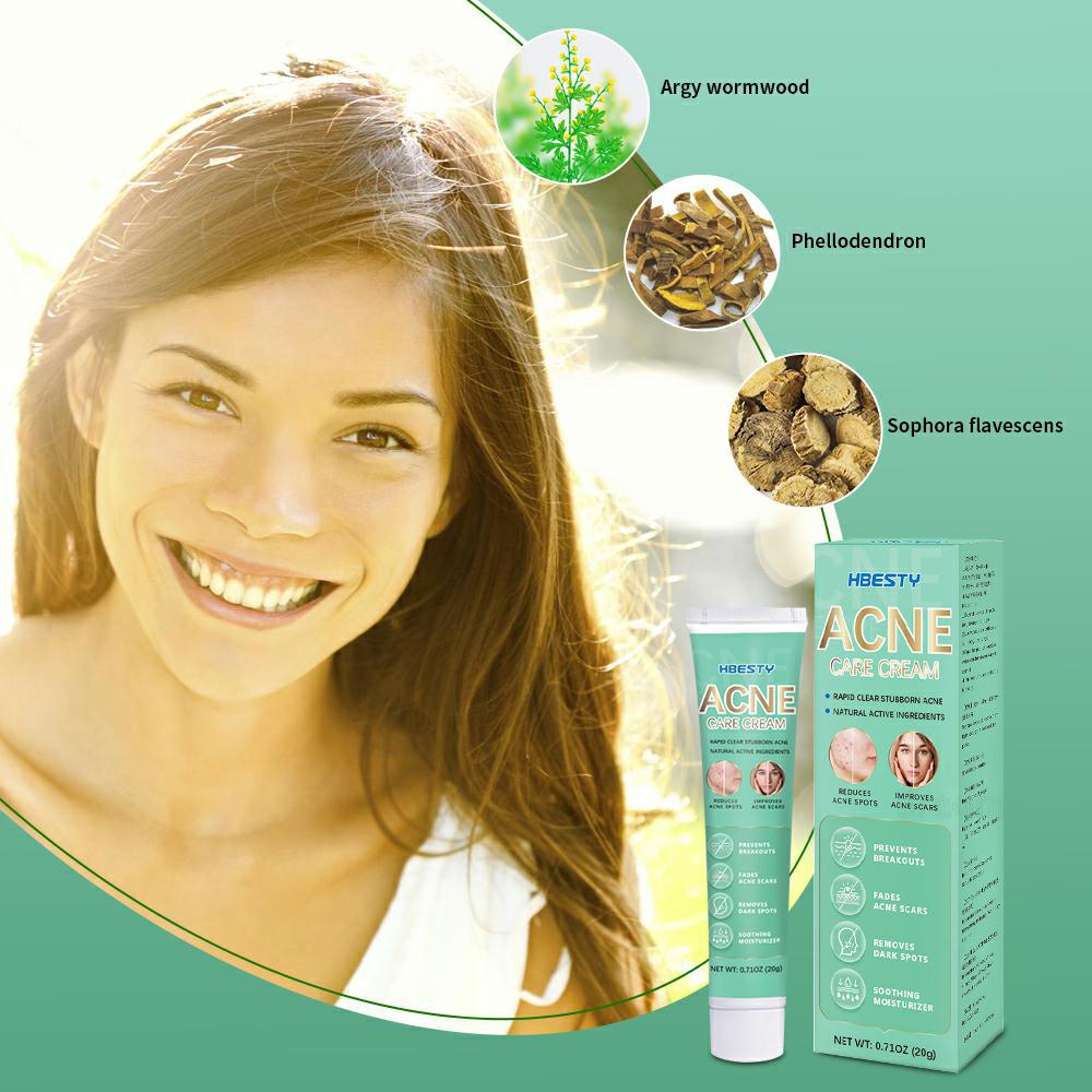 Эффективный крем для удаления прыщей, алоэ, пятна от прыщей, контроль масла, антивозрастной, увлажняющий, отбеливающий крем от прыщей, уход за кожей, 20 г