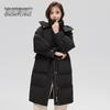 Women's Removable Hood Mid-Length Parka Down Jacket