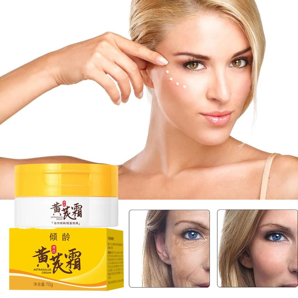 Chinese Astragalus Whitening Freckles Cream Remove Anti-aging Moisturizing Lightening Care Brig N8F7