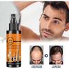 Hair Growth Spray, Promote Hair Growth, Nourish Scalp, Hair Growth Spray, Hair Growth Spray, 100ML/3.38FL