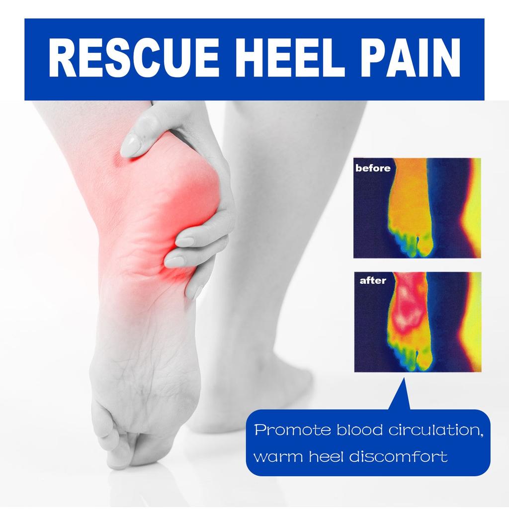 Успокаивающая мазь для пяток, мазь для пяток, боль в суставах, успокаивающая мазь, скованность пяток, легко впитывается, глубоко проникает, 20 г/0,70 унций