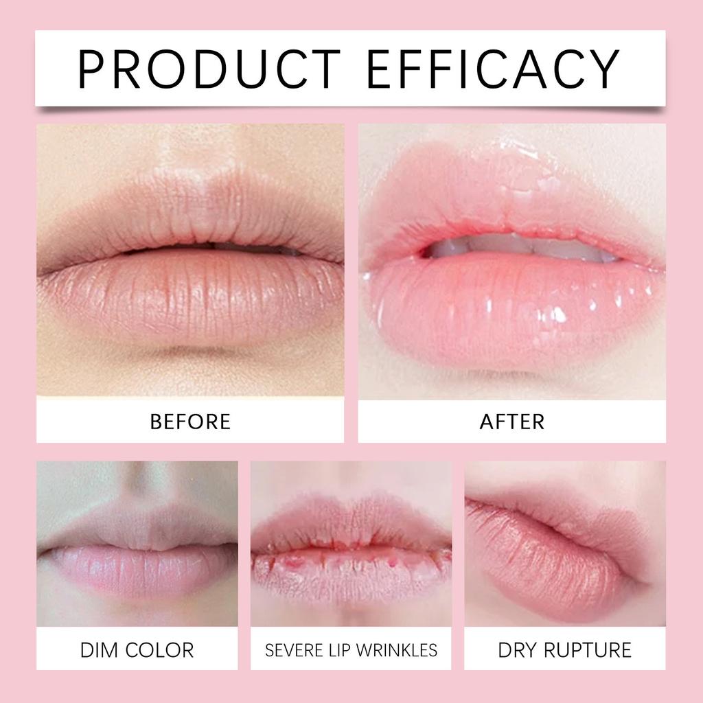 Пластырь для губ Lip Care Patch нежно питает и увлажняет кожу вокруг губ, очищает кератин, пластырь для губ, коллагеновая маска для восстановления морщин на губах, 5 шт., 2 мл