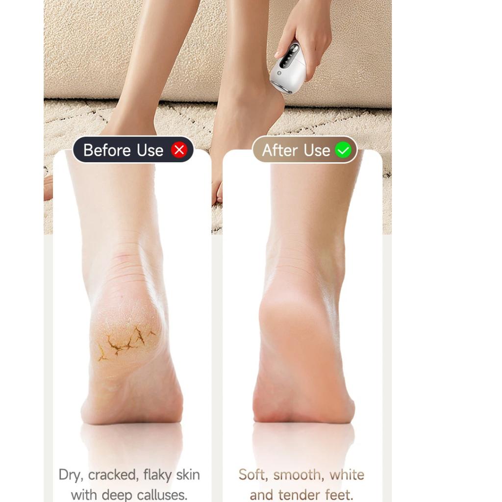 Automatic Electric Foot Grinder USB Rechargeable Callus Remover Pedicure Tool Remove Dead Skin Cracked Heel Foot Care Gadget