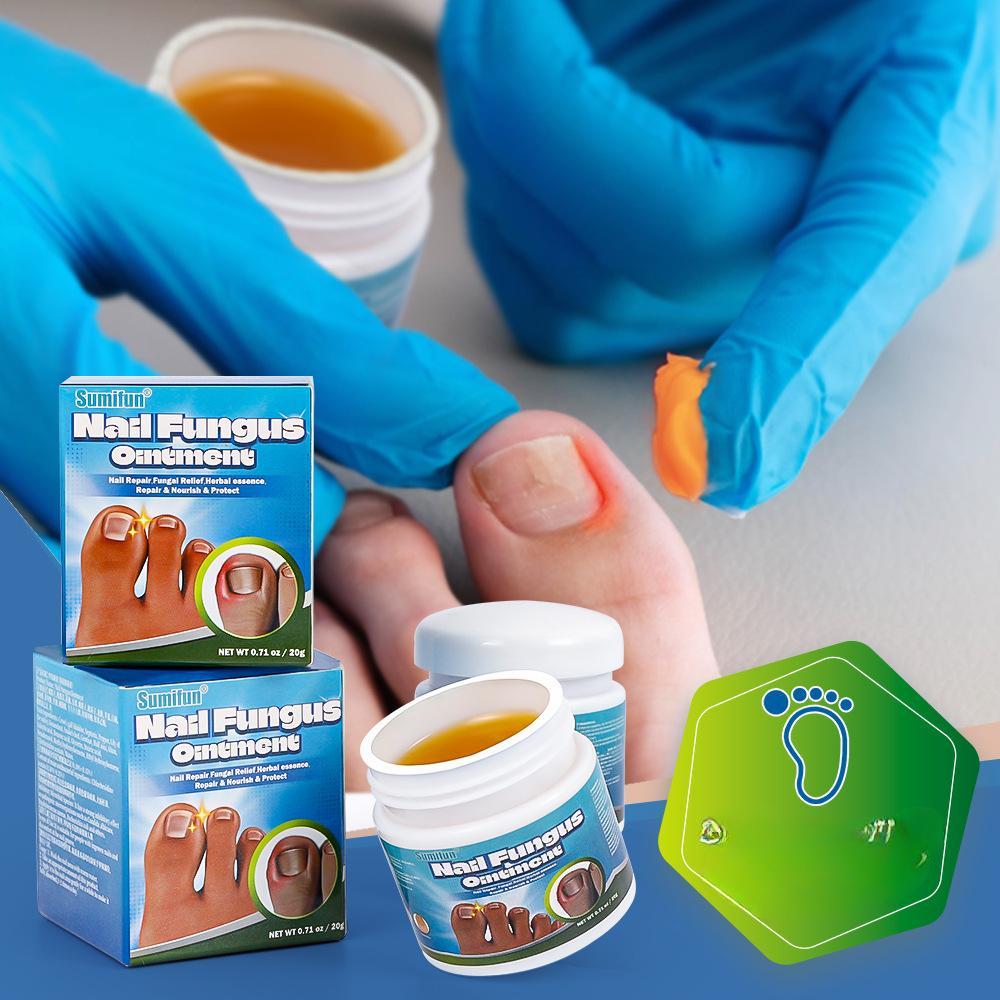 Крем Jiagoukang Cream для ухода за густыми ногтями