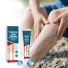 Herbal Varicose Veins Cream Relieves Swelling, Soreness And Reduces Leg Discomfort Anti-Swelling Cream