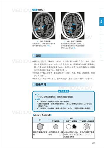 Learning from the Mechanisms of the Human Body: Diagnostic Imaging Technology