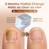 Onychomycosis Instrument Portable Nail Fungus Therapy Laser Device Repair Toenail Fingernail Anti Fungal Tools USB Charge
