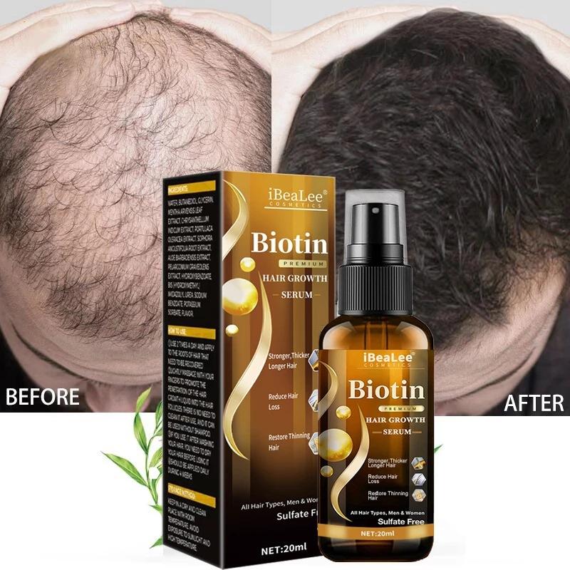 iBeaLee Hair Strengthening Serum Anti-Hair Loss Nourish Roots Scalp Massage Nutrient 100ml