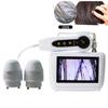 Scalp Hair Follicle Detection Analyzer All-In-One Skin Diagnosis Hair Analyzer High-Definition LCD Screen Digital Home