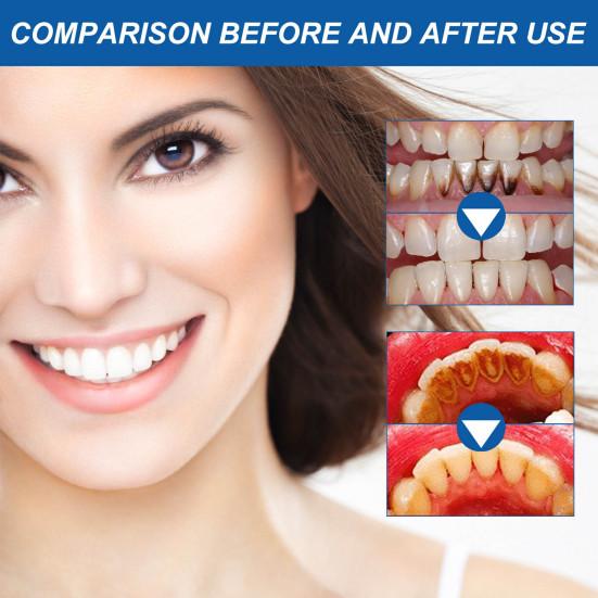 1/2Pcs 4ML Gum Therapy Gel Pen Enamel Safe Gum Shield Oral Care Gel Teeth Whitening Essence Dental Cleaning Brightening Gel