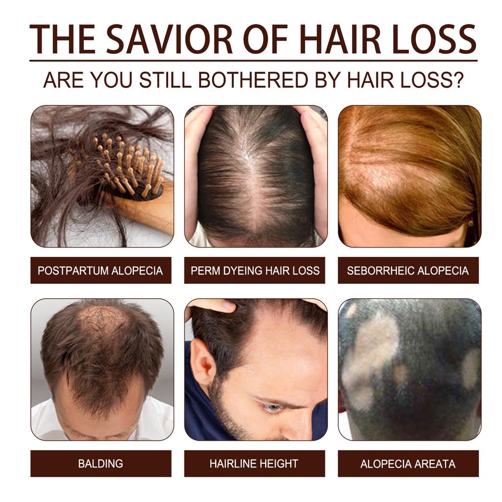 Eelhoe Сыворотка с ферментированной рисовой водой, натуральная нежная рисовая вода, эссенция для волос с ферментированной рисовой водой, сыворотка для роста волос для истонченных волос, 60 мл