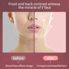 Facial Lifting Device LED Photon Therapy Facial Slimming Vibration Massager V Face Chin Cheek Lift Up Slim Mask Face Lifting Thining Firming