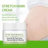 Stretch Marks Remover Cream Eliminate Pregnancy Scars Maternity Repair Anti Winkle Skin Firming