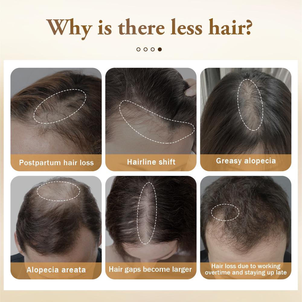 PURC Масло для быстрого роста волос, против выпадения волос, лечебная сыворотка с эфирным маслом имбиря, средства по уходу за волосами