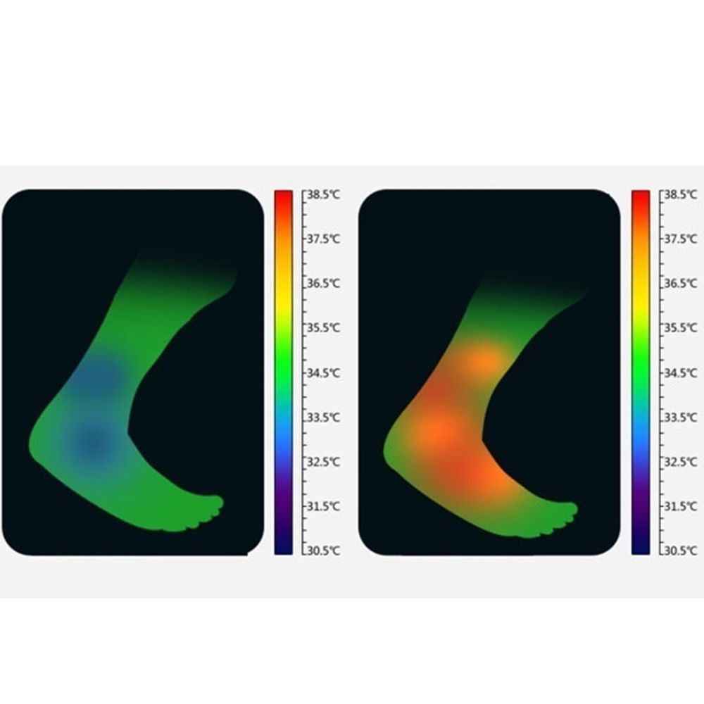 Compression Straps Magnetic Therapy Foot Pad Ankle Support Protector Brace Wrap Belt Health Care