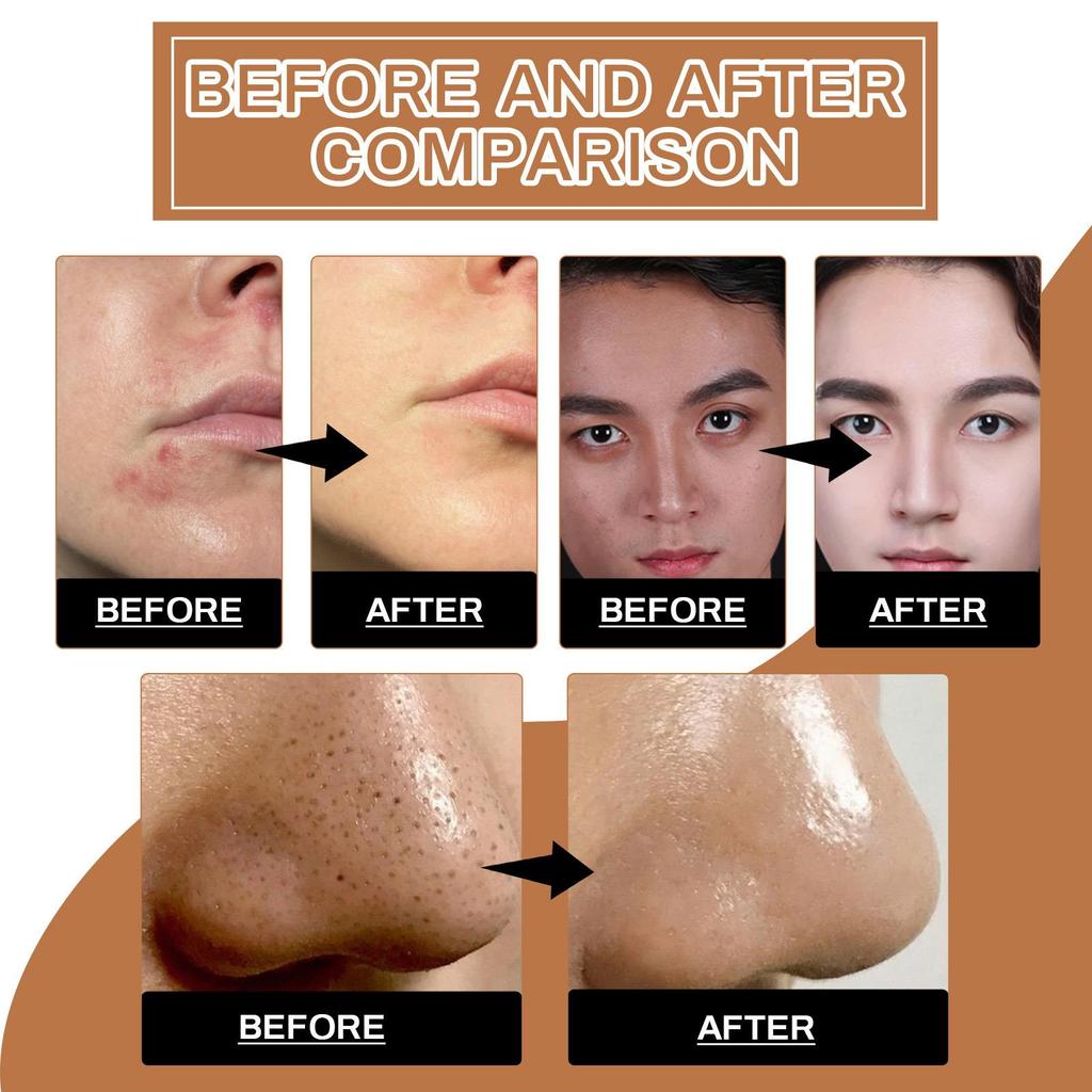 Мужской скраб для лица Глубоко очищающий отшелушивающий скраб для лица