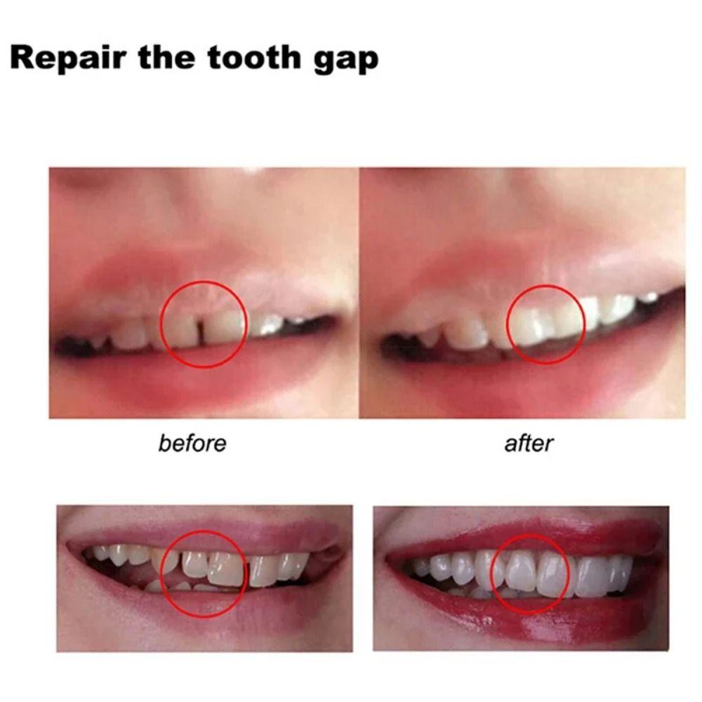 1Pcs Safety Dental Supplies Tooth Repair Glue Temporary Falseteeth Glue Teeth Gaps Filling Solid