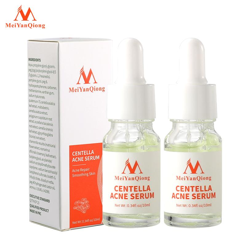 Сыворотка на травах против акне, предотвращает появление морщин. Уменьшает поры. Контролирует жирность кожи лица