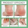 Foot Soak Lymphatic Drainage Foot Soak Natural  Herb Foot Bath Bag Leg Slimming Foot Bath For Reducing Swelling