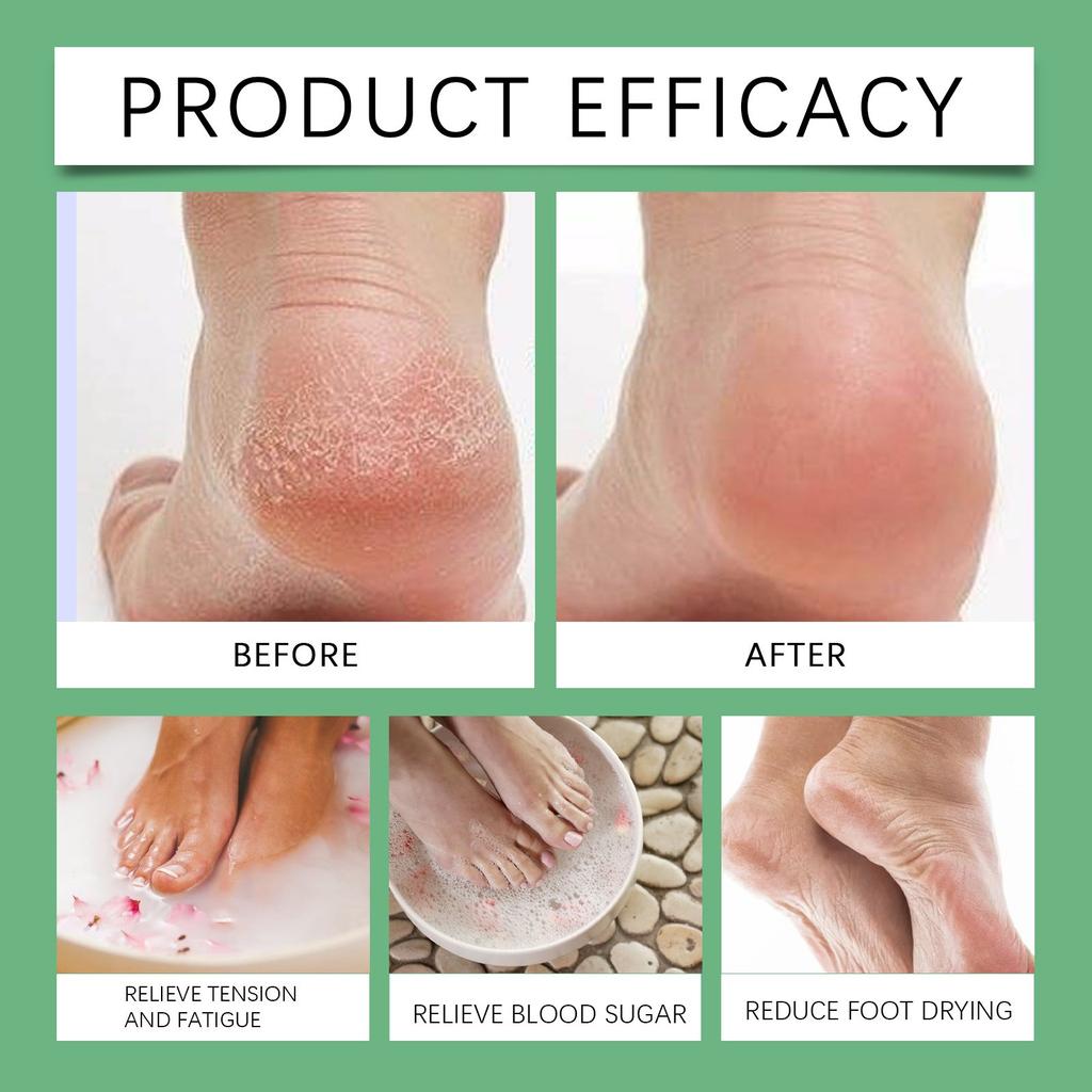 Foot Soak Lymphatic Drainage Foot Soak Natural Herb Foot Bath Bag Leg Slimming Foot Bath For Reducing Swelling