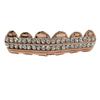 TEMU Gold-Plated Diamond-Studded Grillz Hip-Hop Tooth Jewelry
