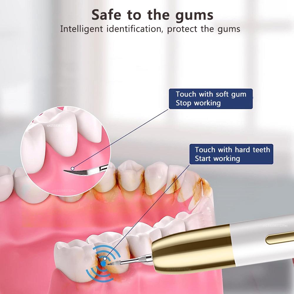 Dental Scaler Ultrasonic Tooth Cleaner Tartar Eliminator Plaque Calculus Remover Electric Removal Teeth Stain Dental Scaling G11