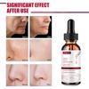 Face Essence Essential Oils Anti Wrinkle Anti-aging Lighten Spots Brightening Facial Skin Fade Remove Freckle Speckle Care