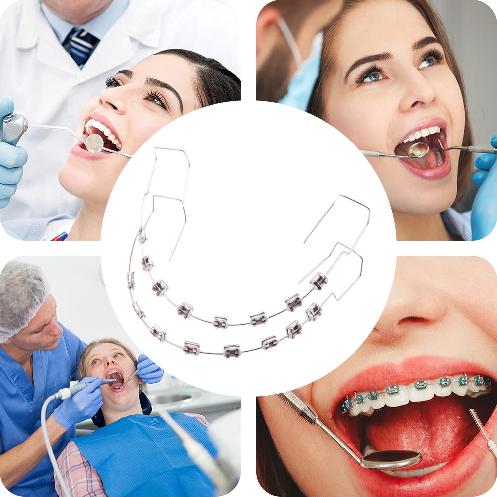 1 пара стоматологических накладных брекетов, металлические дуги, брекеты, временное украшение зубов, стоматологическое модное украшение для ежедневной защиты зубов