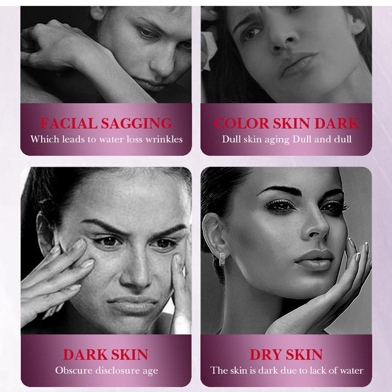 Эссенция витамина B3 для осветления и удаления веснушек, увлажнения и сужения пор