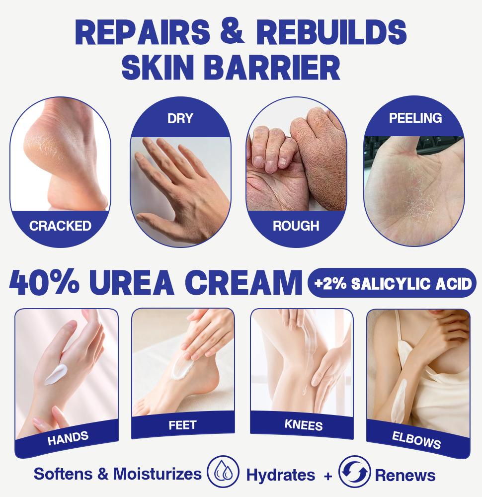 60% Urea Cream, Urea Foot & Hand& Body Cream, Exfoliating Cream, Moisturizer for Thick Skin, Cracked Skin Repair-200g
