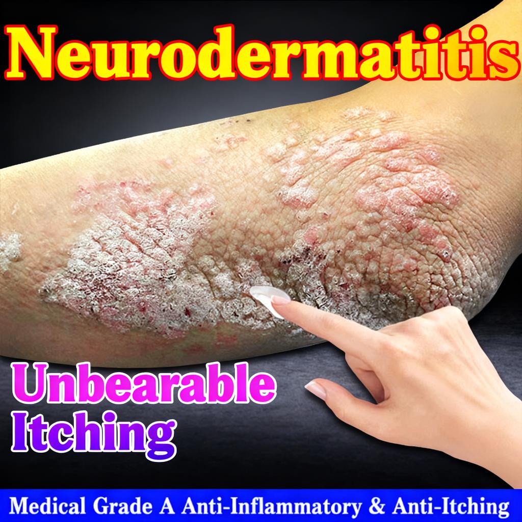 50 г Крем от экземы и грибка, Быстрое облегчение зуда при дерматите и кожных аллергиях, Антисептическая формула