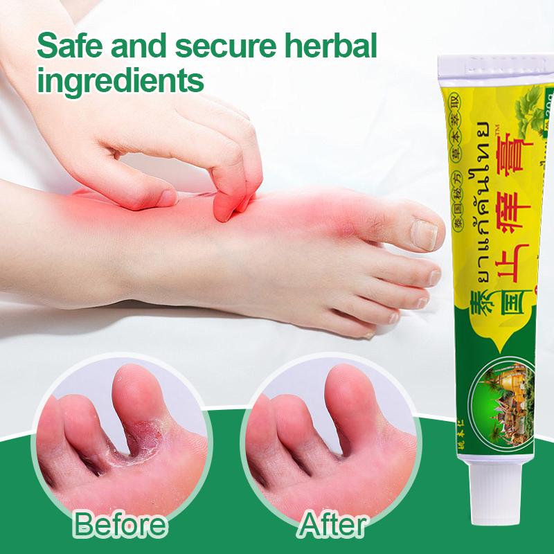 Крем для ног и освежающий крем для ног Athlete's Foot Cream снимает зуд и отшелушивает, устраняет неприятный запах, потливость и вонь от ног