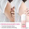 Body Cream Smoothing Skin Lotion Rough Bumpy Treatment Pore Spots Care Moisturizer Whitening Creams 60g
