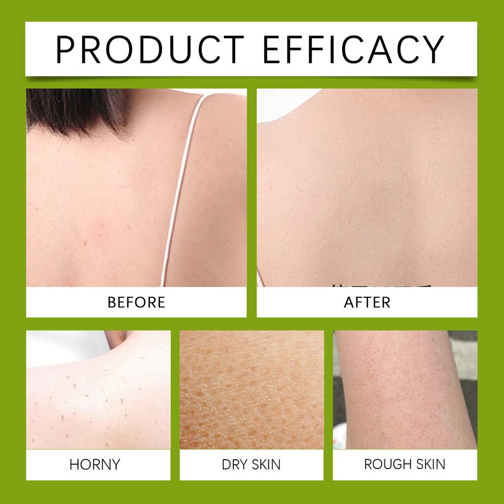 Успокаивающее мыло с маслом чайного дерева, успокаивающее кожу, подходит для чувствительной кожи, склонной к покраснению, отечности и зуду, мыло для ванны