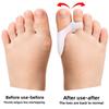Childrens Hallux Valgus Device Big Toe Corrector for Women Adjustable Bunion Relief Double Hole Design