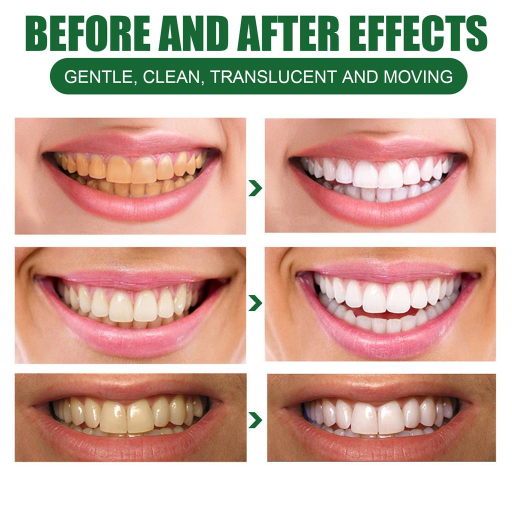 EELHOE Teeth Whitening Mousse Toothpaste Dental Bleaching Deep Cleaning Removes Stains Dentistry Tool Fresh Breath Oral Hygiene Product 60ml