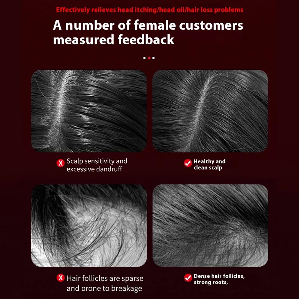 3 Modes Electric Vibration Massage Comb Red Light Therapy Hair Growth Scalp Brush Anti Hair Loss With Liquid Oil Applicator