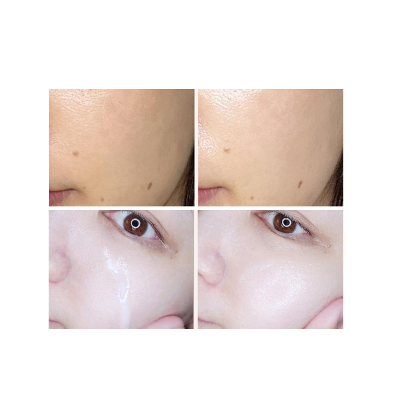 WONJIN EFFECT Melaless Ампула 50г
