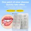 Патч для быстрого лечения язв во рту, повязка для ран полости рта при афтозном стоматите, быстрое облегчение боли, лекарство от афтозного стоматита, обезболивающее