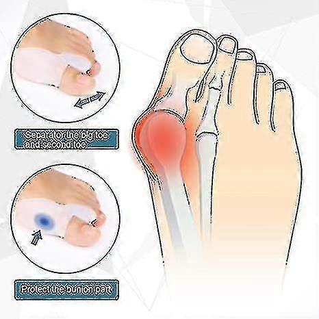 3 Pairs X Gel Bunion Corrector Toe Protectors Straightener Separators Toe Spreader (6 Pcs)