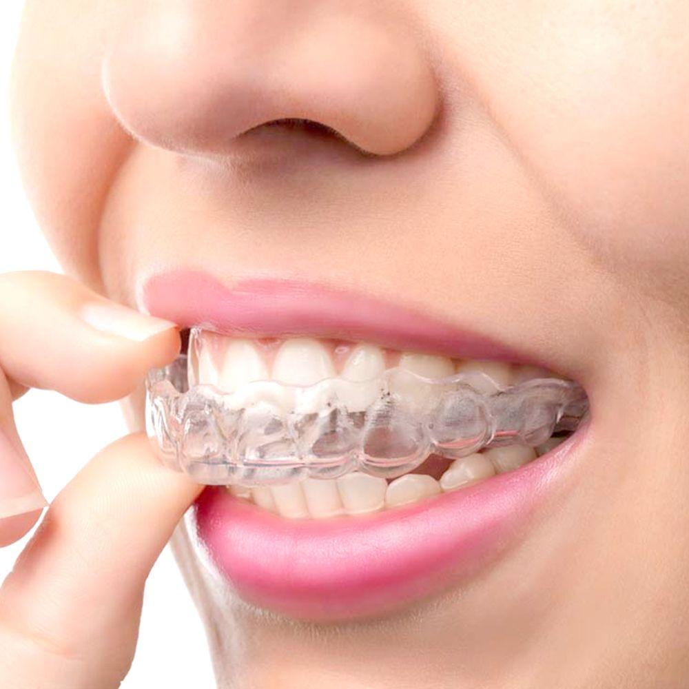 Tooth Protector Sleep Aid Bruxism Mouth Guard Guard Mouth Tray Teeth Whitening Boxing Protection