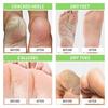 Foot Cure All-Natural Plant Foot Balm – увлажняющий крем для ухода за ногами для сухой кожи