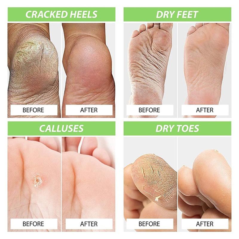 Foot Cure All-Natural Plant Foot Balm – увлажняющий крем для ухода за ногами для сухой кожи