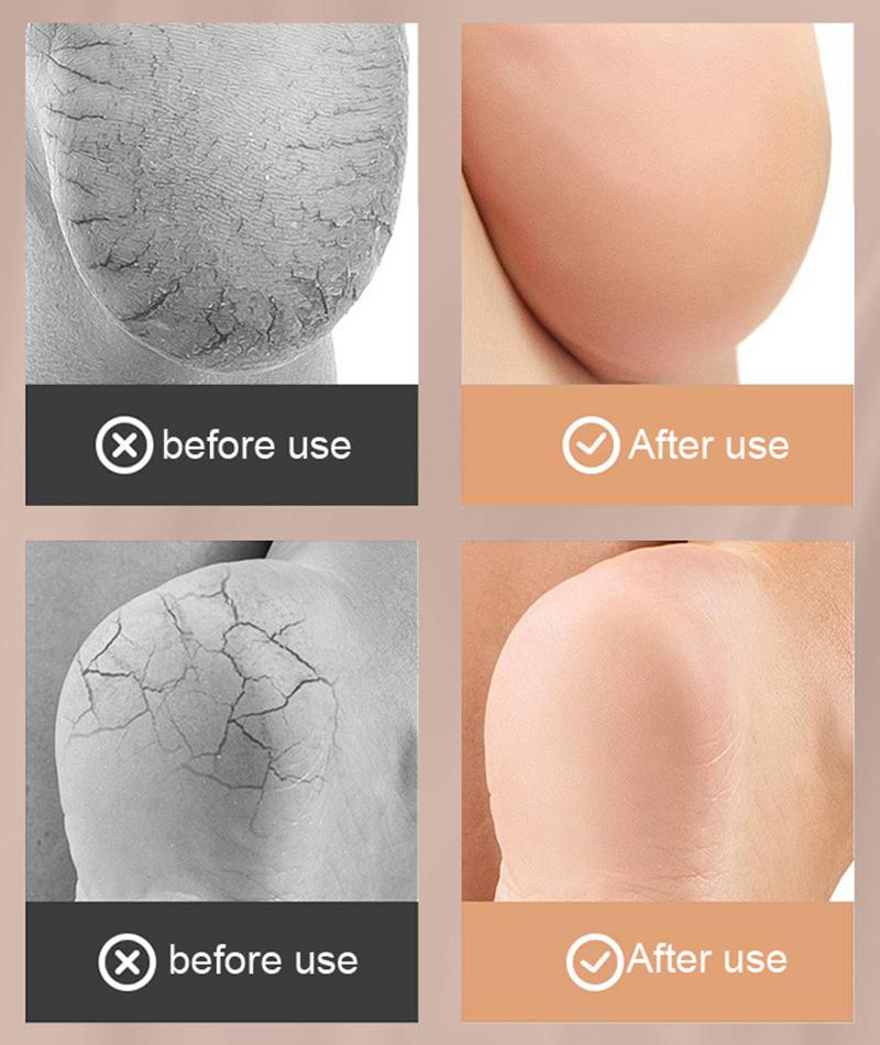 Силиконовые носки для пяток для мужчин и женщин, противотрещинные увлажняющие носки, протектор для облегчения боли в пятке, рукав для ухода за ногами