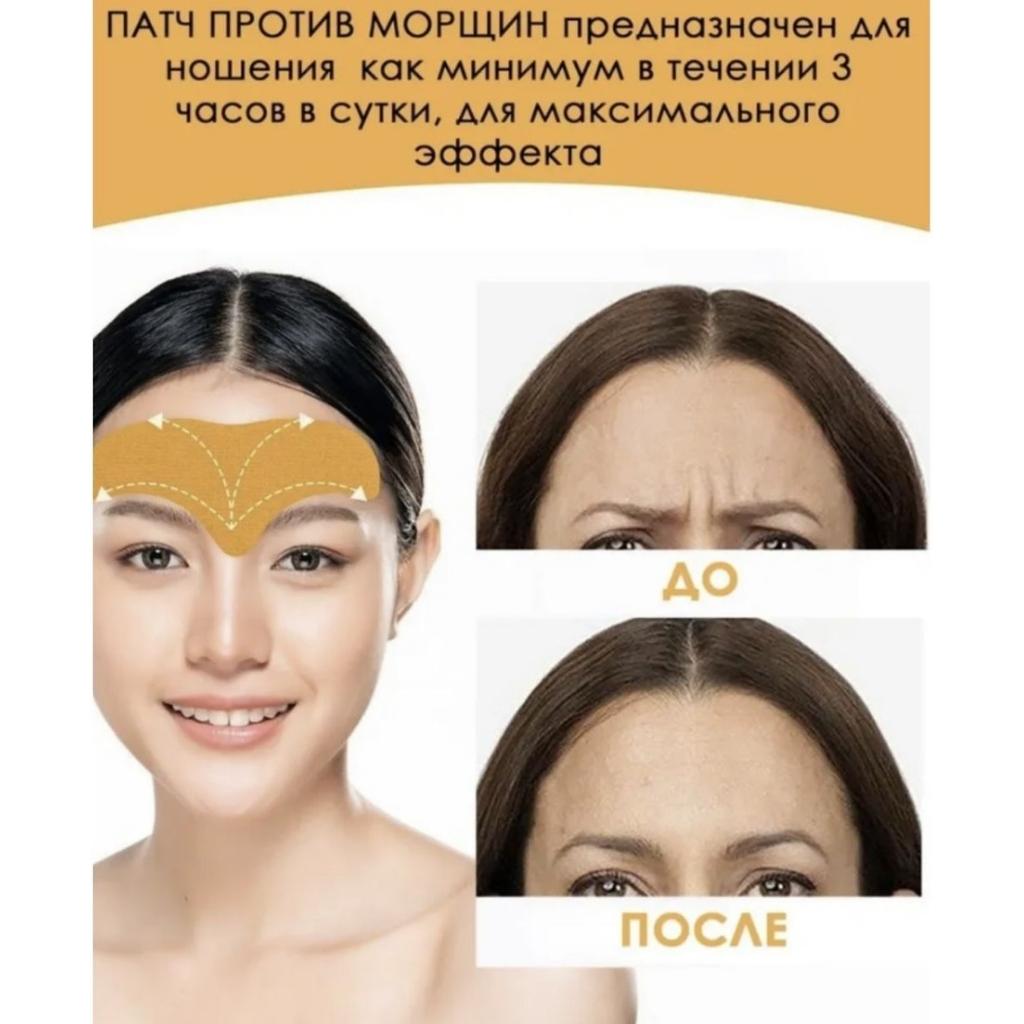 Пластыри от морщин на лбу / пластыри - ленты от морщин