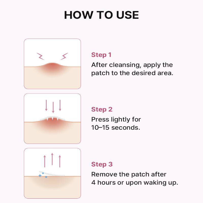 NEEDLY Патч от несовершенств Цветной (12 патчей)