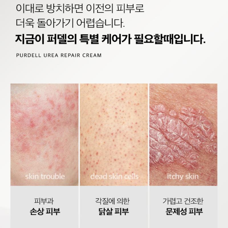 [Purdell] Крем для восстановления EGF с мочевиной 70000ppm 50 мл